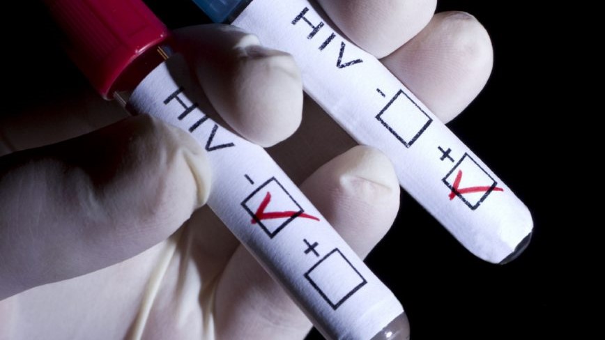 Годинава 41 новорегистрирани со ХИВ/СИДА, тројца починати