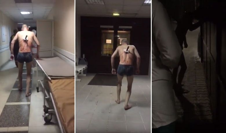 Пациент со нож во грбот се шетал низ болница, тргнал да запали цигара