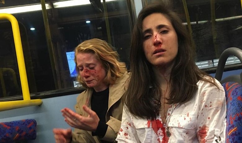 Две девојки претепани во автобус во Лондон бидејќи не сакале да се бакнуваат (ВИДЕО)