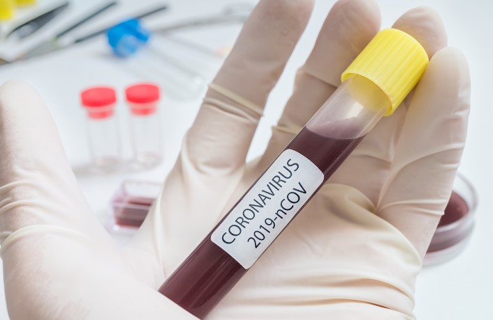 48 нови случаи на коронавирус, починаа четворица пациенти