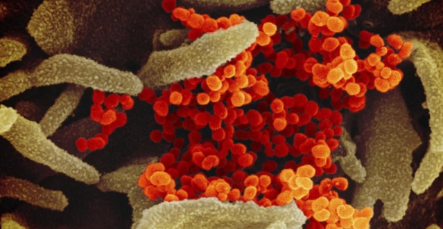 Јапонија откри нова мутација на коронавирусот кај четворица патници од бразилската држава Амазонас