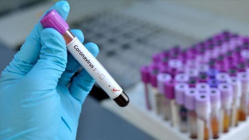Во Хрватска 343 нови случаи на коронавирус и починати 13 лица