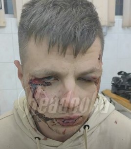Вознемирувачко видео: Украинци крвнички тепаат припадник на Вагнер (ВИДЕО)