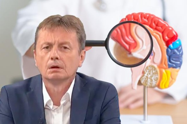 Кои се сиптомите на мозочен удар: Нејасен говор, замаглен вид, трнење на раце и нозе